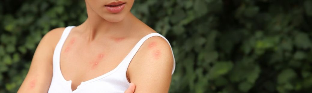 Zaščita pred komarji